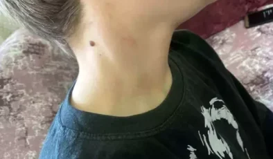 Mudurnu’da Öğrenci Darbedildi, Öğretmene İşlem Başlatıldı